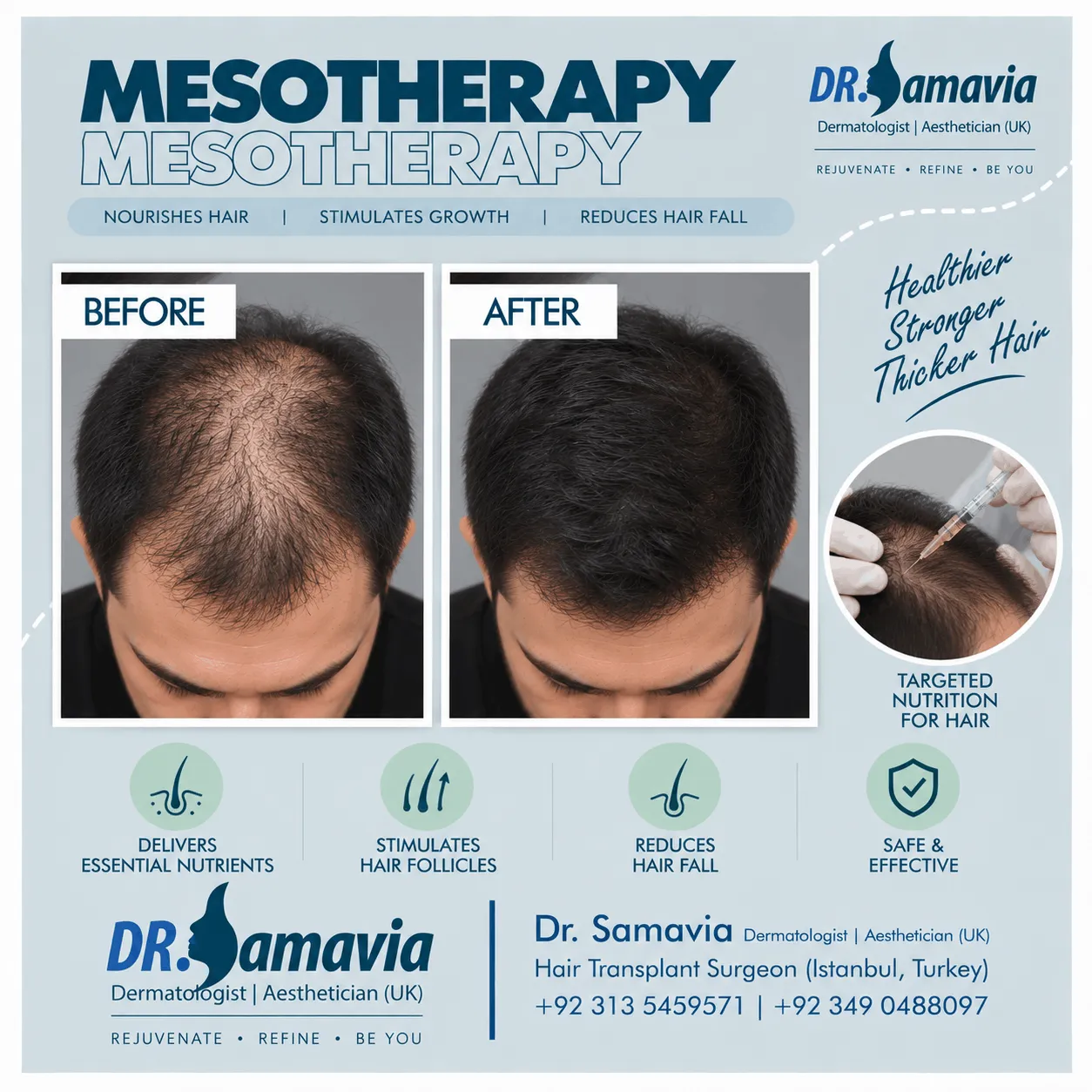 Mesotherapy