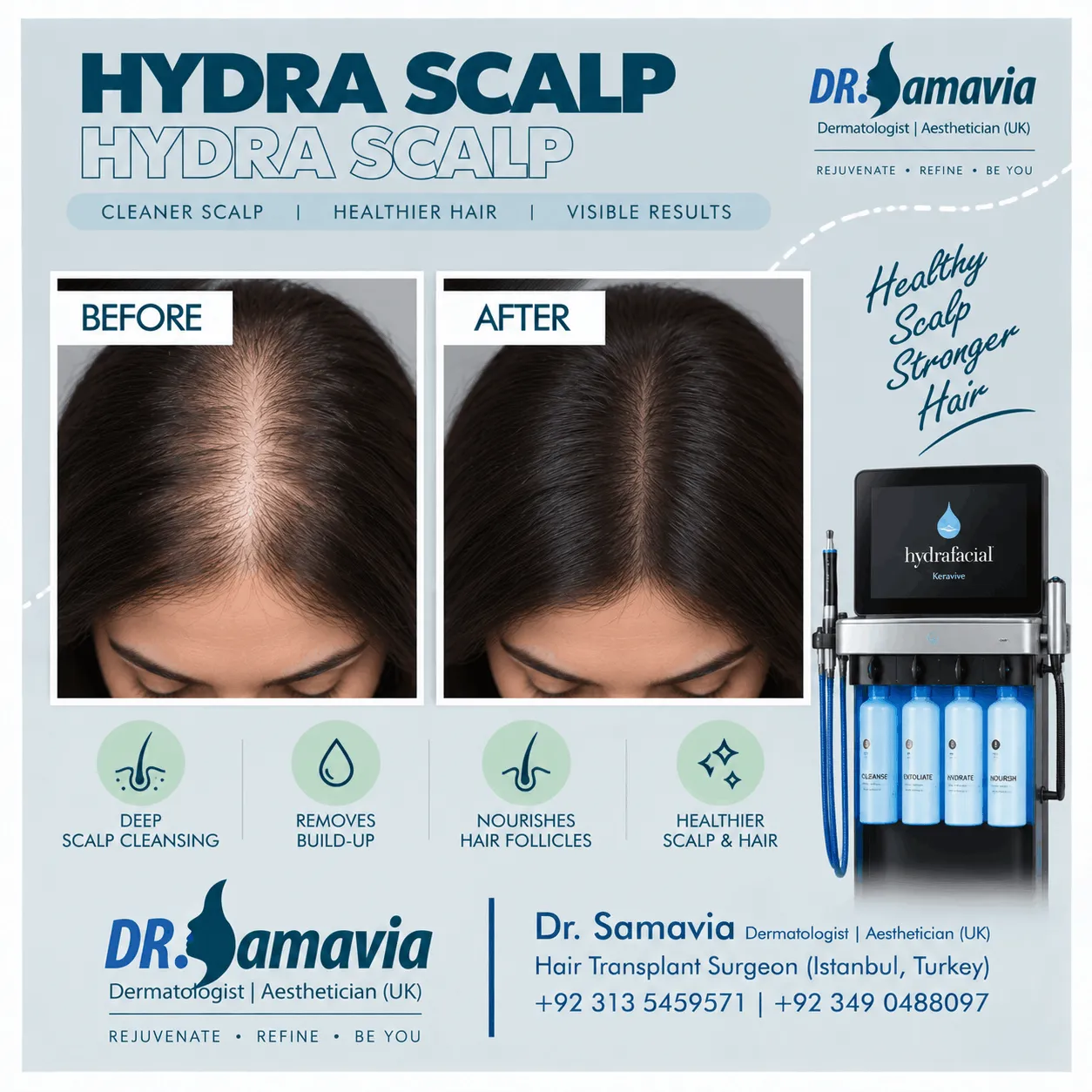 Hydra Scalp